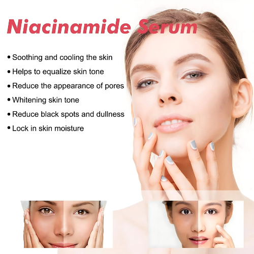 Niacinamide Zinc Oil Control Serum