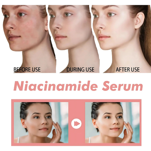 Niacinamide Zinc Oil Control Serum