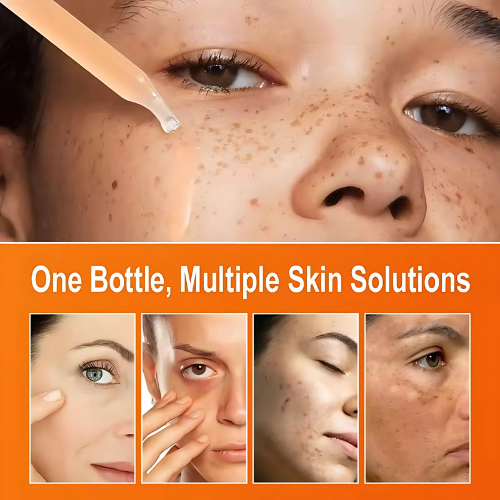 Vitamin C Brightening Serum 30ml – Dark Spot Fader & Glow Booster